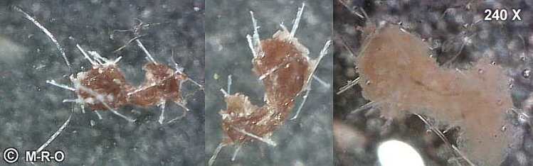 Morgellons microscopic pictures photos of unnown fungus fibers gmo pics