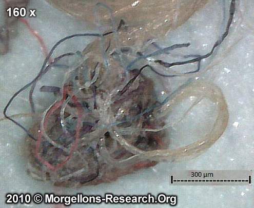 Morgellons Biofilm-Filament bundles