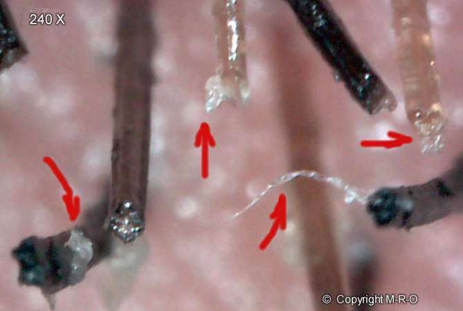 morgellons-hairs5.jpg (21513 Byte)