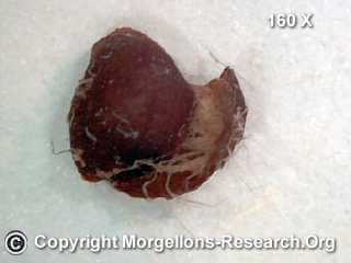 Morgellons Bild von Rhizobium radiobacter1
