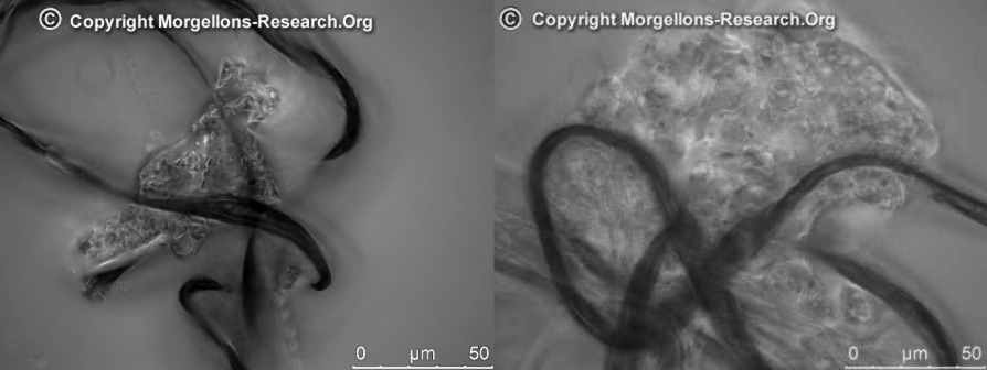 Morgellons herauswachsender Biofilm aus Filament